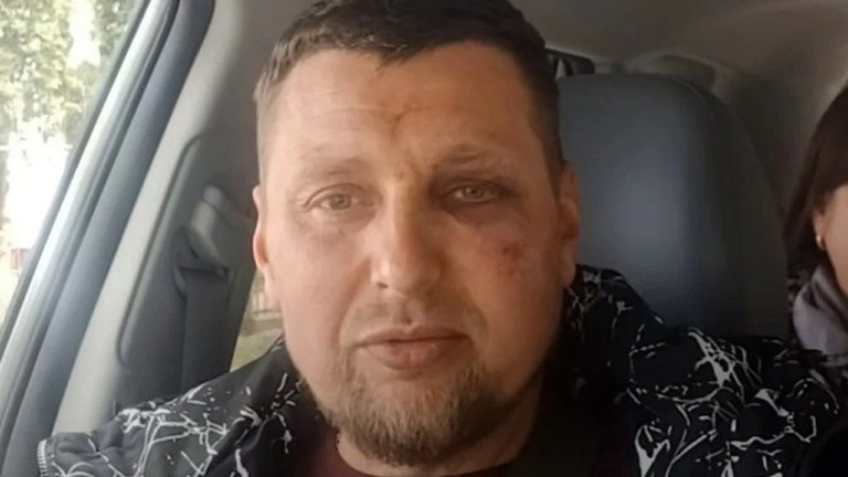 Ветеран з інвалідністю звинувачує співробітників ТЦК у побитті в Луцьку